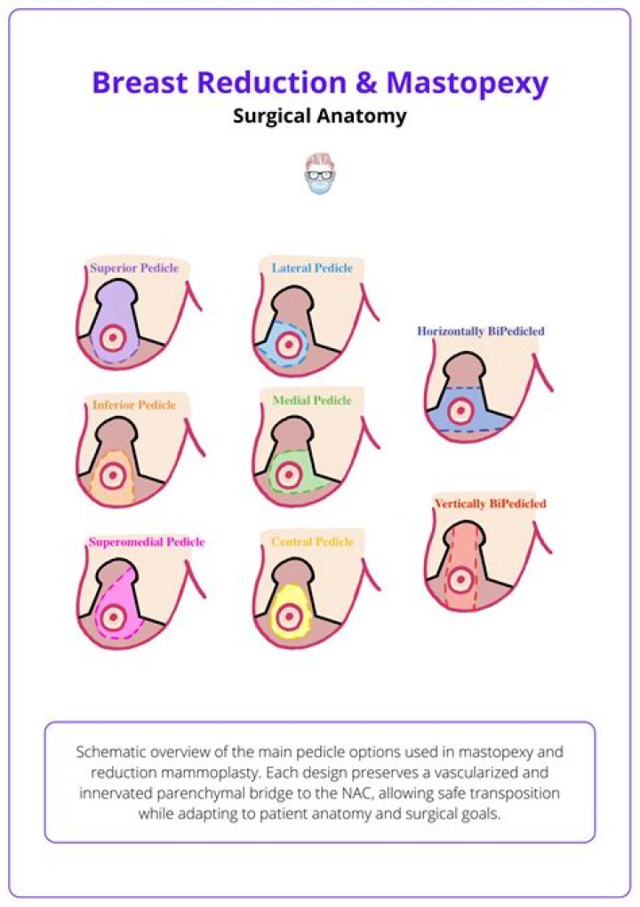 Was ist eine mastectomy?
