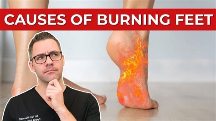What causes red burning feet?