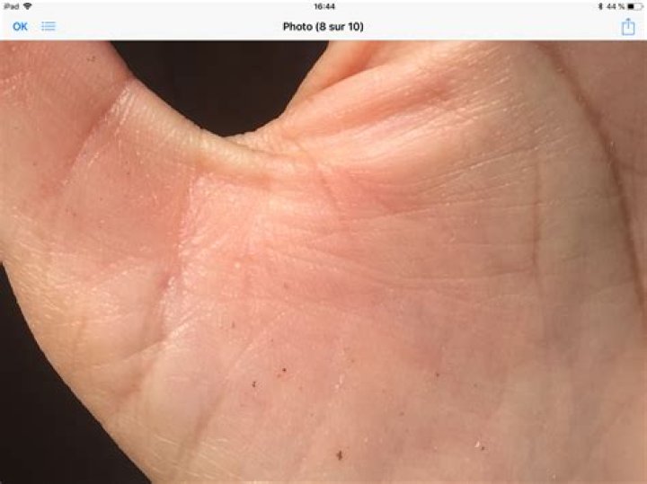 What causes rust colored stains on hands?