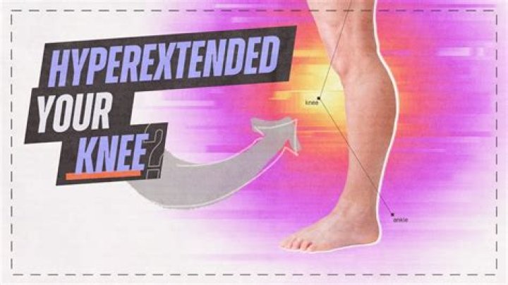 What does hyperextend your knee mean?