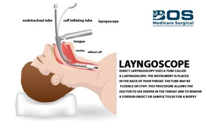 What does laryngoscopy test for?