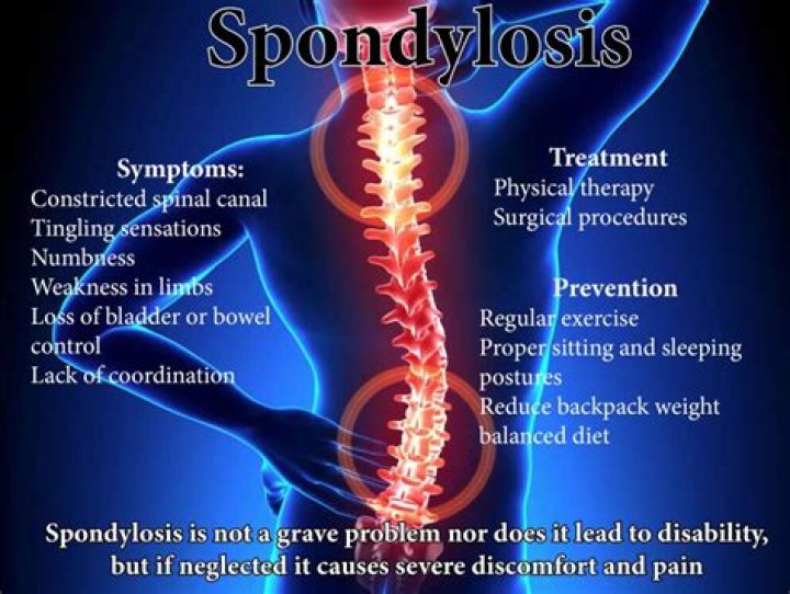 What does the word spondylalgia?