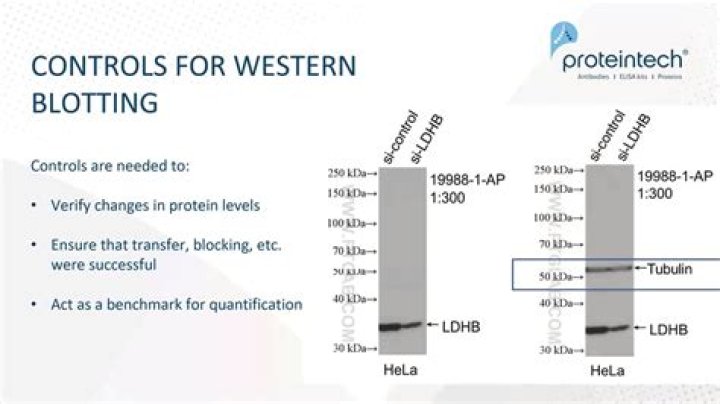 What is a loading control in western blot?