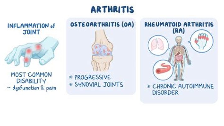 What is flitting arthritis?