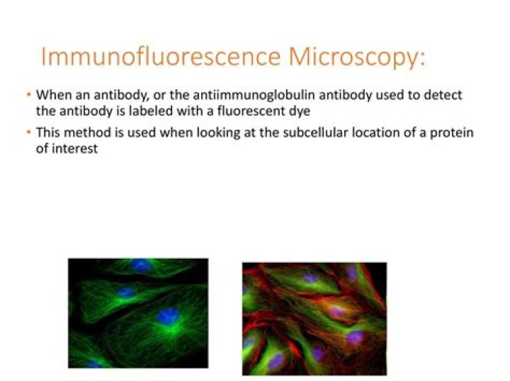 What is immunofluorescence microscopy used for?