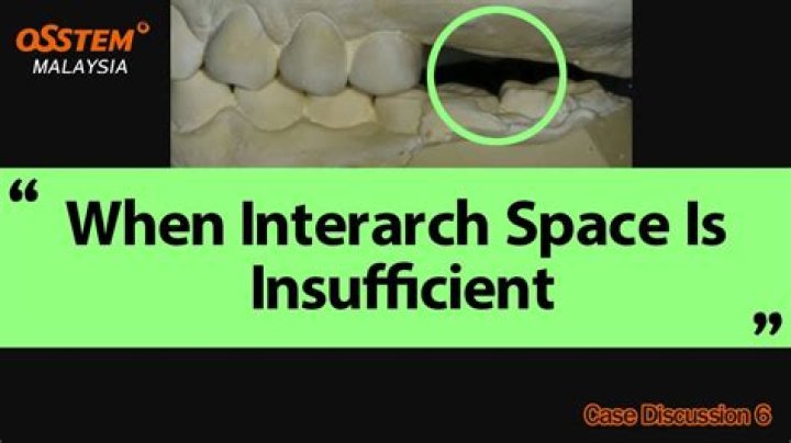 What is interarch space?
