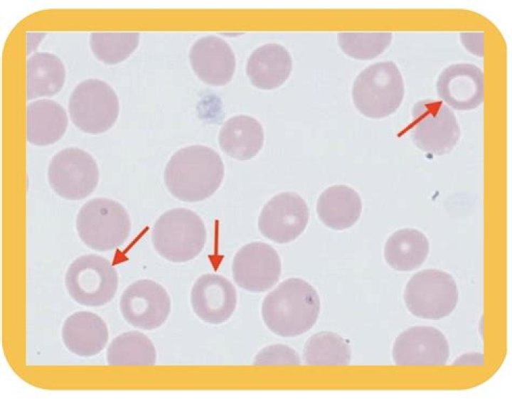 What is mean extracorpuscular?