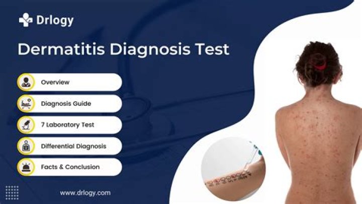 What is meant by dermatographism?