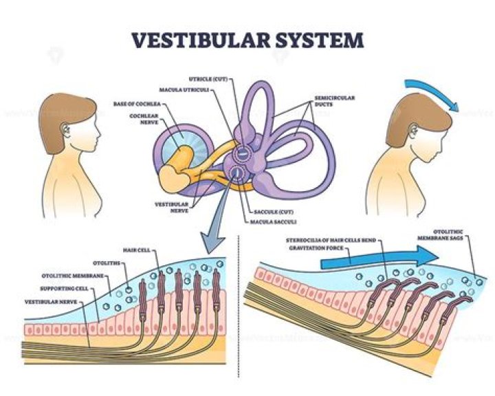 What is peripheral vestibular hypofunction?
