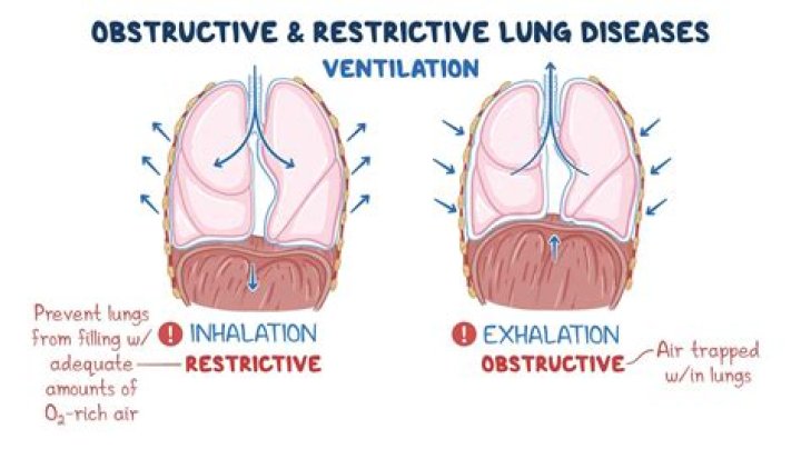What is restrictive airway disease?