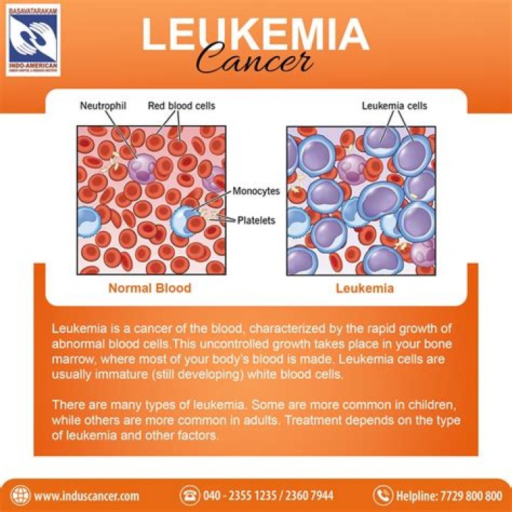 What is the prevalence of leukemia cancer?