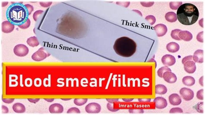 Whats a blood smears?