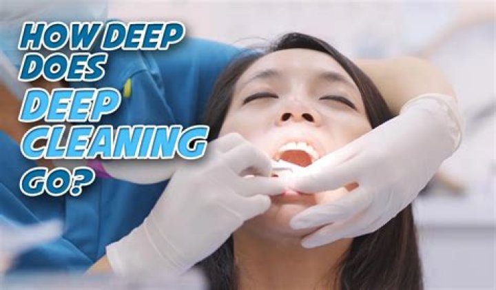 Whats a deep cleaning at the dentist?