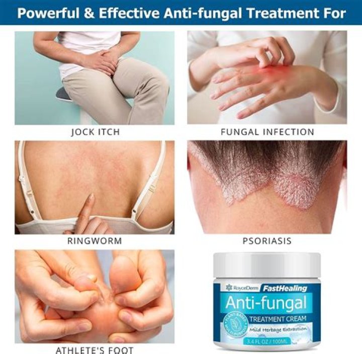 Whats a good antifungal?