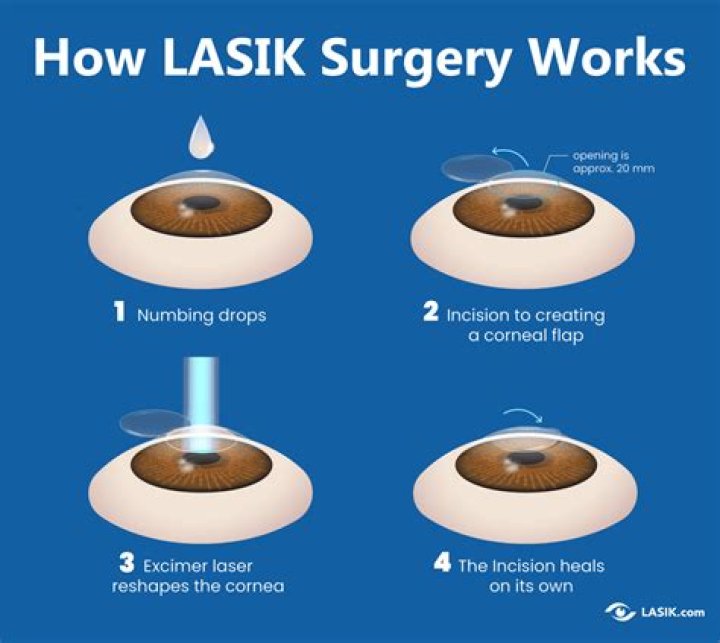 Whats lasik eye surgery?