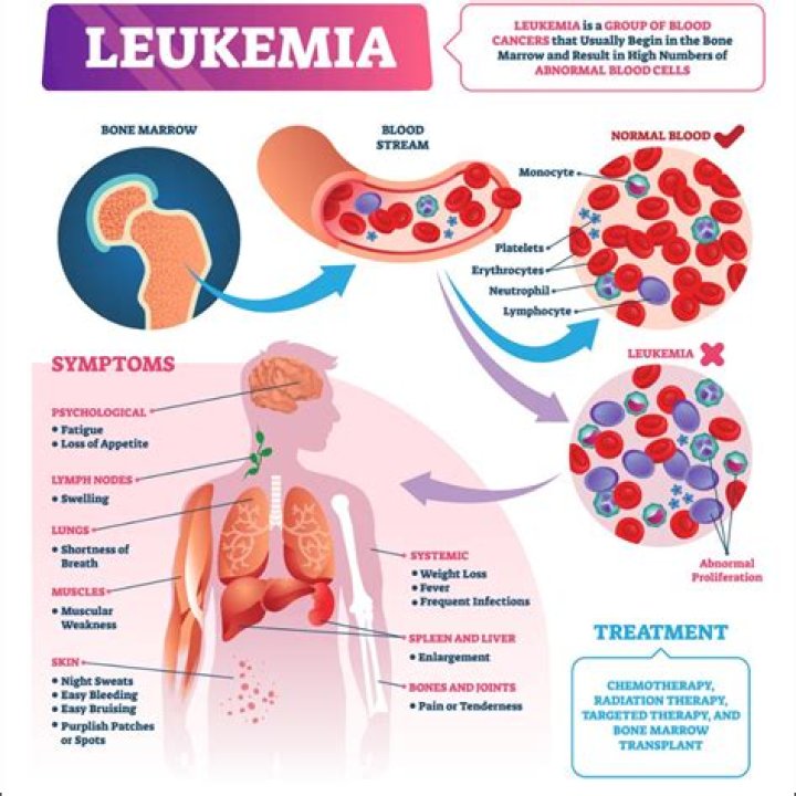 Whats the symptoms of leukemia?