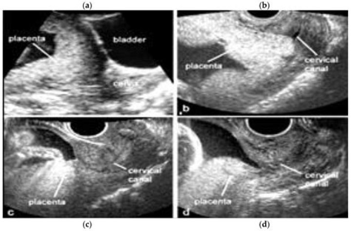 When can you see deformities in ultrasound?