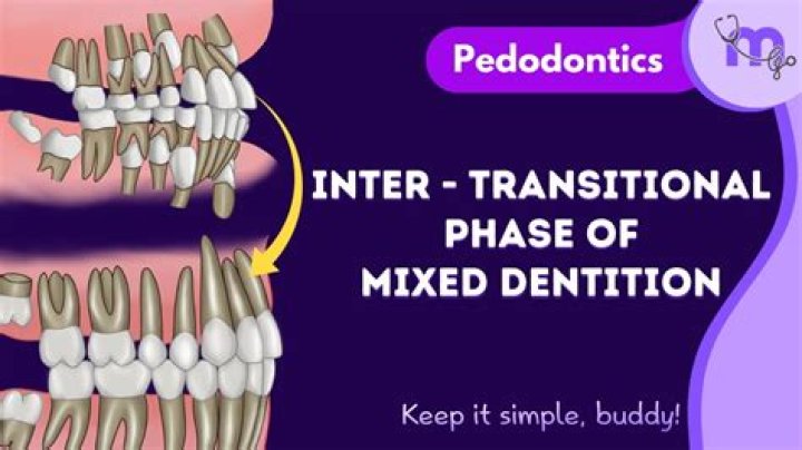 When does mixed dentition begin?