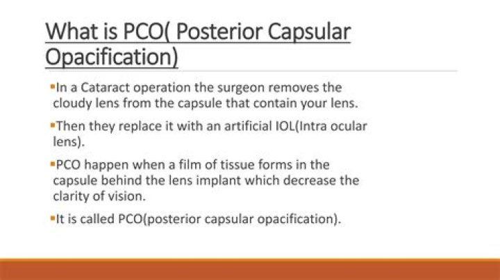 When does posterior capsule opacification occur?