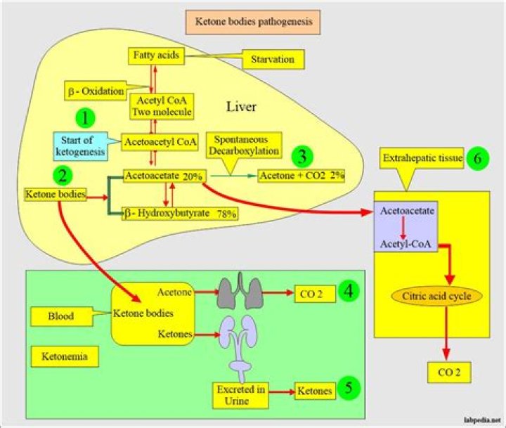Where can ketonuria be found?