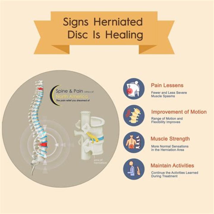 Where do herniated discs hurt?