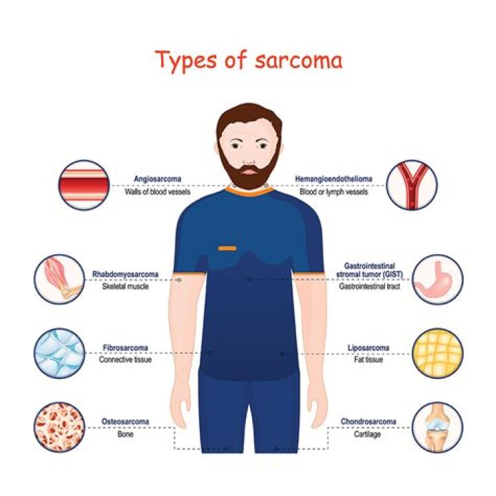 Where do sarcomas grow?