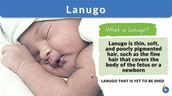 Where does lanugo go?