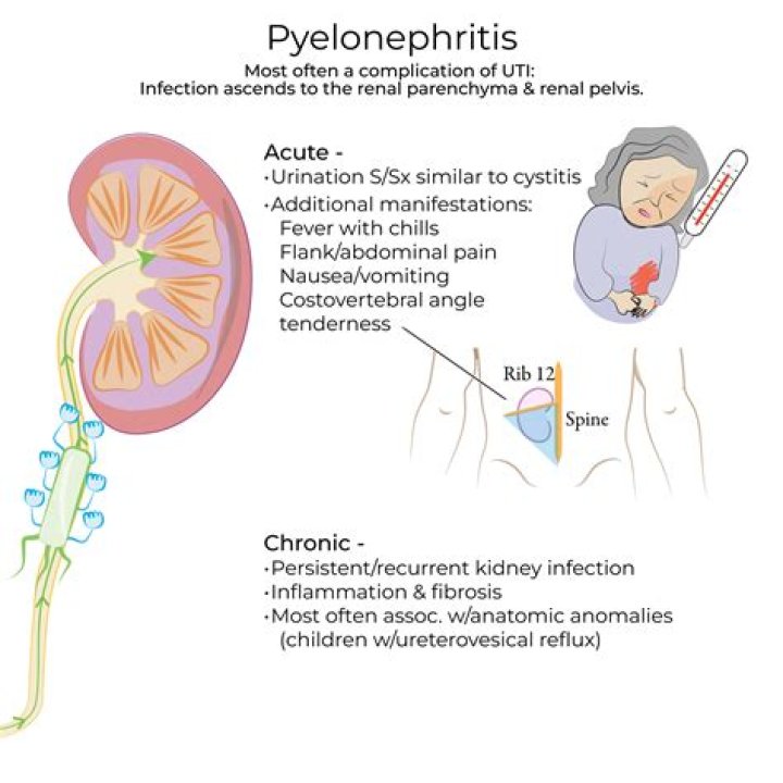 Where is chronic pyelonephritis?