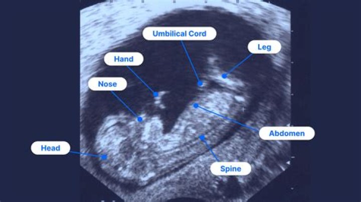 Where ultrasound is used?
