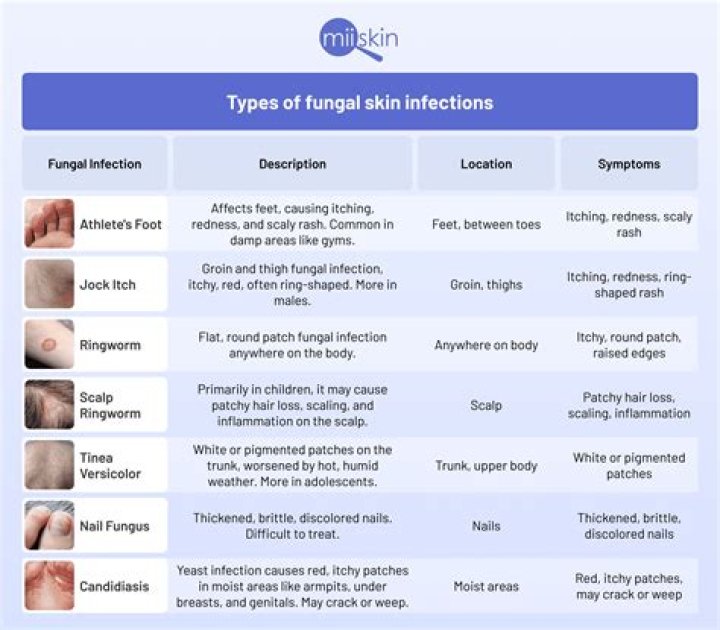 Which antifungal is best for intertrigo?