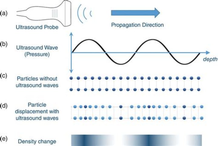 Which type of waves are produced in sonometer experiment?