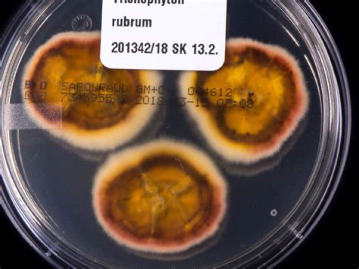 Who discovered trichophyton rubrum?