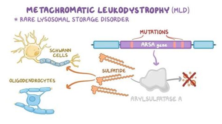 Who is affected by metachromatic leukodystrophy?