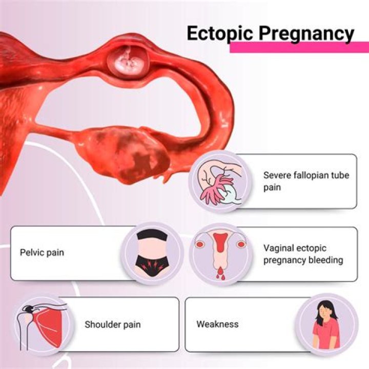 Why can't an ectopic pregnancy be reimplanted?