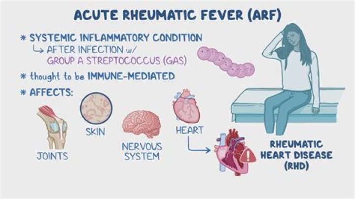 Why chorea in rheumatic fever?