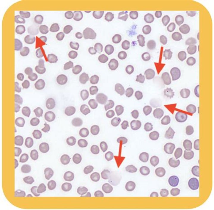 Why do red blood cells crenate?