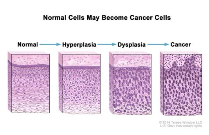 Why does metaplasia mean?