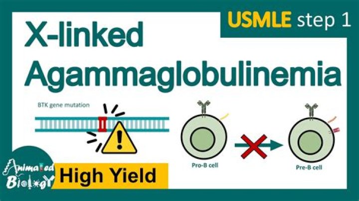 Why is agammaglobulinemia bad?