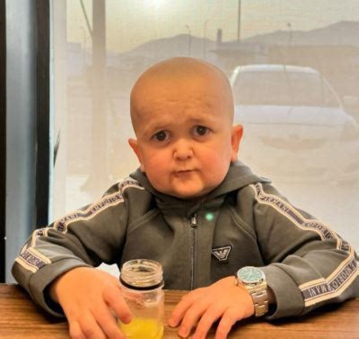 Why is hasbulla so small?