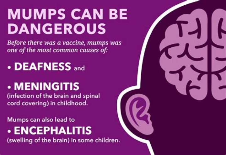Why is mumps an infectious disease?