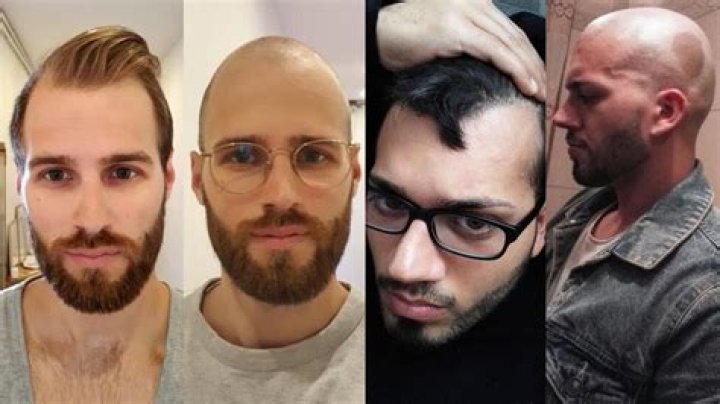 Why man shave head?