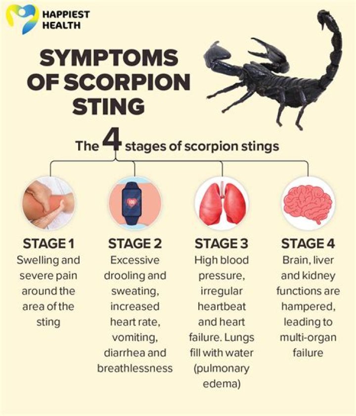 Will a scorpion sting kill you?