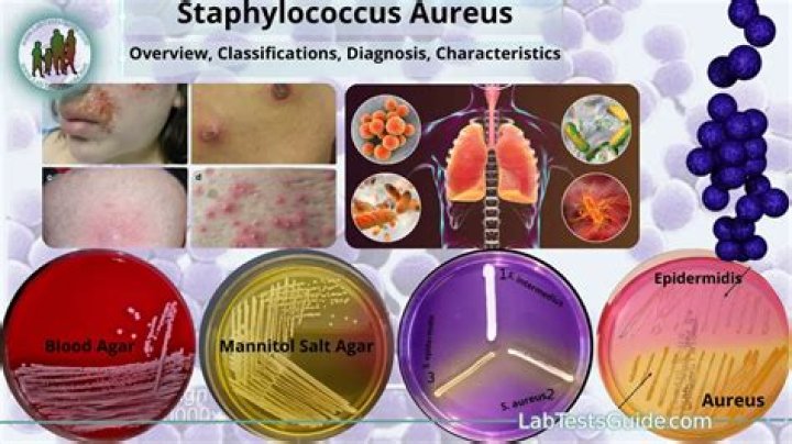 Will keflex treat staphylococcus aureus?