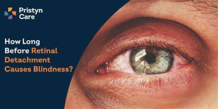 Will retinal detachment cause blindness?