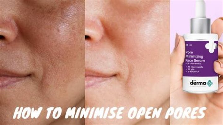 Will toner minimize pores?