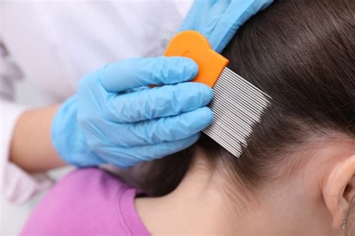Will using a straightener kill lice?